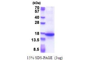 SDS-PAGE (SDS) image for Microfibrillar Associated Protein 3 (MFAP3) (AA 19-147) protein (His tag) (ABIN5853672) (MFAP3 Protein (AA 19-147) (His tag))