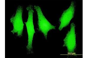 Immunofluorescence of monoclonal antibody to LMO1 on HeLa cell. (LMO1 antibody  (AA 1-90))