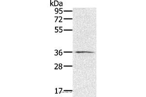 Western blot analysis of TM4 cell, using RNF144B Polyclonal Antibody at dilution of 1:400 (RNF144B antibody)