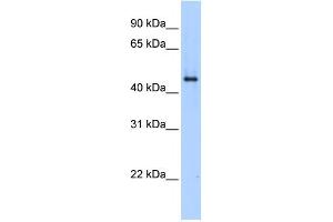 SERPINE1 antibody used at 1 ug/ml to detect target protein. (PAI1 antibody  (N-Term))
