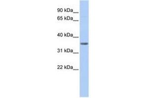 Image no. 1 for anti-Pyruvate Dehydrogenase beta (PDHB) (AA 72-121) antibody (ABIN6741021) (PDHB antibody  (AA 72-121))