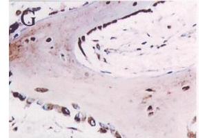 Immunohistochemistry image of Osteonectin staining in par- affn section offetal calvaria. (SPARC antibody)