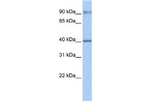 Western Blot showing AIM2 antibody used at a concentration of 1-2 ug/ml to detect its target protein. (AIM2 antibody  (N-Term))