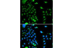 Immunofluorescence analysis of MCF-7 cells using UBE2J2 antibody (ABIN5974418). (UBE2J2 antibody)