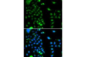 Immunofluorescence analysis of MCF-7 cells using UBE2J2 antibody (ABIN5974418). (UBE2J2 antibody)