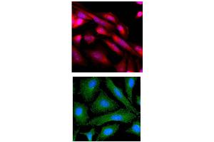 ICC/IF analysis of MAPK3 in HeLa cells line, stained with Hoechst 3342 (Blue) for nucleus staining and monoclonal anti-human MAPK3 antibody (1:500) with goat anti-mouse IgG-Texas Red conjugate (Red). (ERK1 antibody  (AA 1-137))