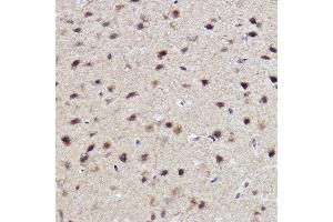 Immunohistochemistry of paraffin-embedded mouse brain using  Rabbit mAb (ABIN7265552) at dilution of 1:100 (40x lens). (ALKBH1 antibody)