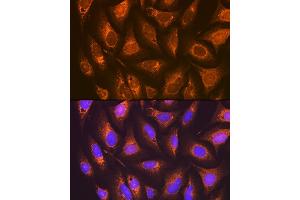 Immunofluorescence analysis of U-2 OS cells using PGE Receptor EP2 (PGE Receptor EP2 (PGE receptor EP2 (PTGER2))) Rabbit mAb (ABIN7269572) at dilution of 1:100 (40x lens). (PTGER2 antibody)
