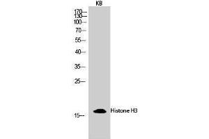 Western Blotting (WB) image for anti-Histone 3 (H3) (Lys428) antibody (ABIN3185033) (Histone 3 antibody  (Lys428))