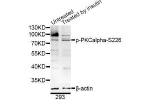 Western blot analysis of extracts of 293 cells, using Phospho-PKCalpha-S226 antibody (ABIN5996200) at 1/1000 dilution. (PKC alpha antibody  (pSer226))