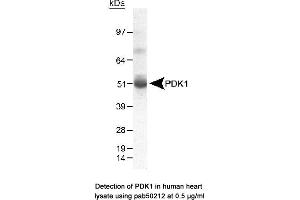Image no. 1 for anti-Pyruvate Dehydrogenase Kinase (AA 300-400) antibody (ABIN363521) (Pyruvate Dehydrogenase Kinase (AA 300-400) antibody)