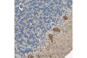 Immunohistochemical staining of human cerebellum with NEXN polyclonal antibody  shows moderate cytoplasmic positivity in purkinje cells. (NEXN antibody)