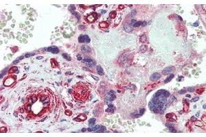 Detection of dLL4 in Human Placenta Tissue using Polyclonal Antibody to Delta Like Protein 4 (dLL4) (DLL4 antibody  (AA 215-331))