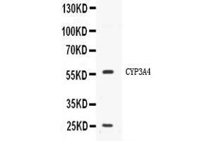 Western blot analysis of CYP3A4 expression in HELA whole cell lysates ( Lane 1). (CYP3A4 antibody  (Middle Region))