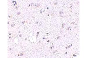 Immunohistochemical staining of human brain tissue with 2. (LASS5 antibody  (N-Term))