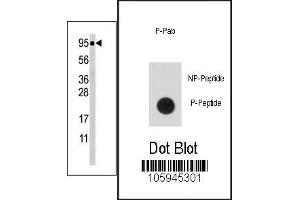 Image no. 1 for anti-Signal Transducer and Activator of Transcription 5A (STAT5A) (pSer726) antibody (ABIN358237) (STAT5A antibody  (pSer726))