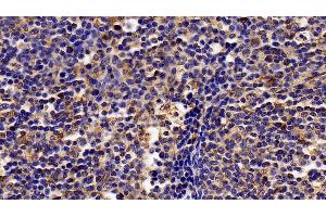 Immunohistochemistry (IHC) image for anti-Interferon alpha/beta Receptor 2 (IFNAR2) (AA 27-243) antibody (ABIN7435736)