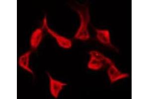 ABIN6278625 staining COLO205 by IF/ICC. (RASSF4 antibody  (Internal Region))