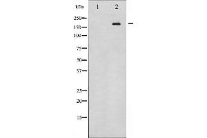 Western blot analysis of HER4 expression in whole cell lysates,The lane on the left is treated with the antigen-specific peptide. (ERBB4 antibody  (C-Term))