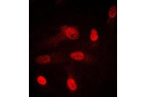Immunofluorescent analysis of SGK1/2 staining in HeLa cells. (SGK1/2 (Center) antibody)