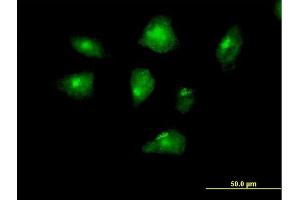 Immunofluorescence of purified MaxPab antibody to FSHPRH1 on HeLa cell. (CENPI antibody  (AA 1-522))