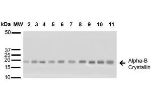 Western blot analysis of Human A431, HCT116, HeLa, HepG2, HEK293, HUVEC, Jurkat, MCF7, PC3 and T98G cell lysates showing detection of ~22 kDa Alpha B Crystallin protein using Rabbit Anti-Alpha B Crystallin Polyclonal Antibody (ABIN361836 and ABIN361837).