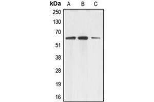 Western blot analysis of Adracalin expression in A431 (A), HEK293T (B), HeLa (C) whole cell lysates.