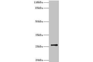 Western blot All lanes: TK1 antibody at 2 μg/mL + CEM whole cell lysate Secondary Goat polyclonal to rabbit IgG at 1/10000 dilution Predicted band size: 26 kDa Observed band size: 26 kDa (TK1 antibody  (AA 2-234))