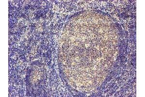 Immunohistochemical staining of paraffin-embedded Human tonsil using anti-MAGEB18 mouse monoclonal antibody.