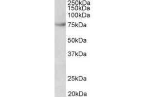 Western Blotting (WB) image for anti-Far Upstream Element (FUSE) Binding Protein 1 (FUBP1) (Internal Region) antibody (ABIN2465130) (FUBP1 antibody  (Internal Region))