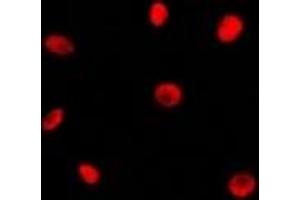Immunofluorescent analysis of RAD21 staining in Jurkat cells.