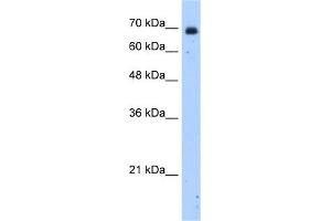 WB Suggested Anti-HSZFP36 Antibody Titration:  2.