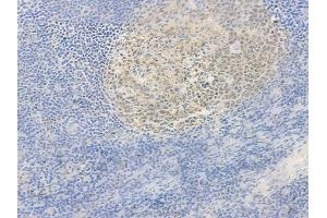 ABIN6264360 and ABIN6278002 at 1/100 staining human normal tonsil tissue by IHC-P. (POU2AF1 antibody  (C-Term))
