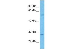 Host:  Rabbit  Target Name:  DERL3  Sample Tissue:  Human Liver Tumor  Antibody Dilution:  1ug/ml (Derlin-3 antibody  (Middle Region))