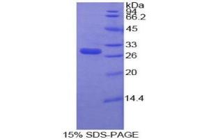 SDS-PAGE analysis of Human MMP16 Protein. (MMP16 Protein)