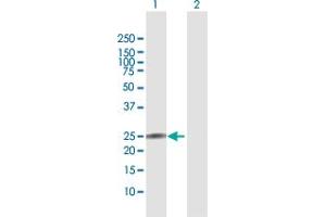Western Blot analysis of IL22 expression in transfected 293T cell line by IL22 MaxPab polyclonal antibody. (IL-22 antibody  (AA 1-179))