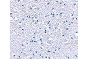 Immunohistochemical staining of human brain tissue using AP30385PU-N Grik4 antibody at 2. (GRIK4 antibody  (N-Term))