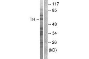 Western blot analysis of extracts from NIH-3T3 cells, treated with Forskolin 40nM 30', using Tyrosine Hydroxylase (Ab-40) Antibody. (Tyrosine Hydroxylase antibody  (AA 41-90))