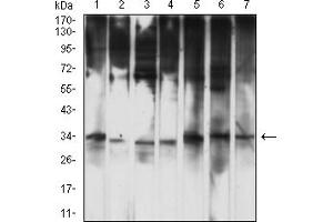 Western Blotting (WB) image for anti-HtrA Serine Peptidase 2 (HTRA2) (AA 278-458) antibody (ABIN7193389)