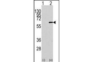 Western blot analysis of AKT1 Antibody (N-term) polyclonal antibody (ABIN391212 and ABIN2841290) (arrow). (AKT1 antibody  (N-Term))