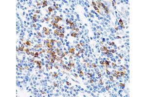 Immunohistochemistry of paraffin-embedded Human tonsil using TNFSF12 Polyclonal Antibody at dilution of 1:100 (40x lens). (TWEAK antibody)