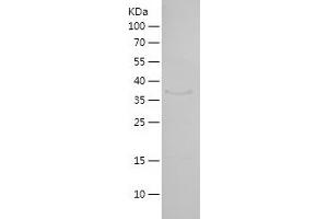 HEY1 Protein (AA 156-304) (His-IF2DI Tag)