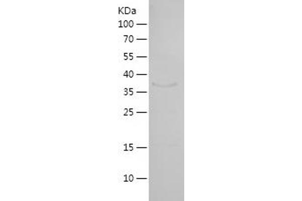 HEY1 Protein (AA 156-304) (His-IF2DI Tag)