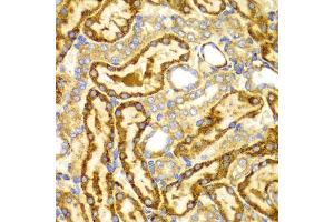 Immunohistochemistry of paraffin-embedded rat kidney using LAMP3 antibody (ABIN5971497) at dilution of 1/100 (40x lens). (LAMP3 antibody)