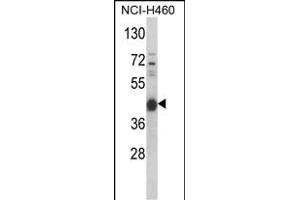 Western blot analysis of PRKACA Antibody (N-term K82) (ABIN390798 and ABIN2841043) in NCI- cell line lysates (35 μg/lane). (PRKACA antibody  (N-Term))