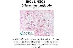 Image no. 1 for anti-Leucine Rich Repeat and Ig Domain Containing 1 (LINGO1) (C-Term) antibody (ABIN1736452) (LINGO1 antibody  (C-Term))