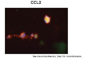 Sample Type: Human Macrophange CellsGreen: primaryRed: phallodinBlue: DAPIYellow: green/redPrimary Dilution: 1:200Secondary Antibody: anti-Rabbit IgG-FITCSecondary Dilution: 1:1000Image Submitted By: Milan FialaUniversity of California, Los Angeles (CCL2 antibody  (Middle Region))