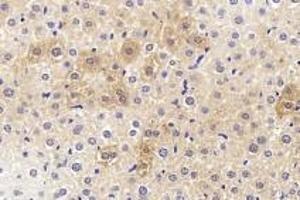 Immunohistochemistry analysis of paraffin-embedded mouse liver using Endostatin (ABIN7073823) at dilution of 1:1200 (COL18A1 antibody)