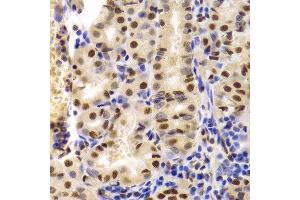 Immunohistochemistry of paraffin-embedded human stomach using XRCC5 Antibody. (XRCC5 antibody  (AA 543-732))