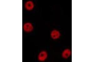 ABIN6277629 staining Hela by IF/ICC. (PRDM14 antibody  (N-Term))